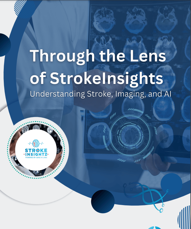 Stroke White Paper
