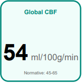 MRI ASL Insightz — Global CBF