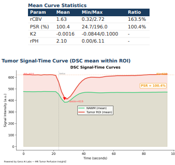 MRI Tumor Insightz — DSC signal-time curve & statistics
